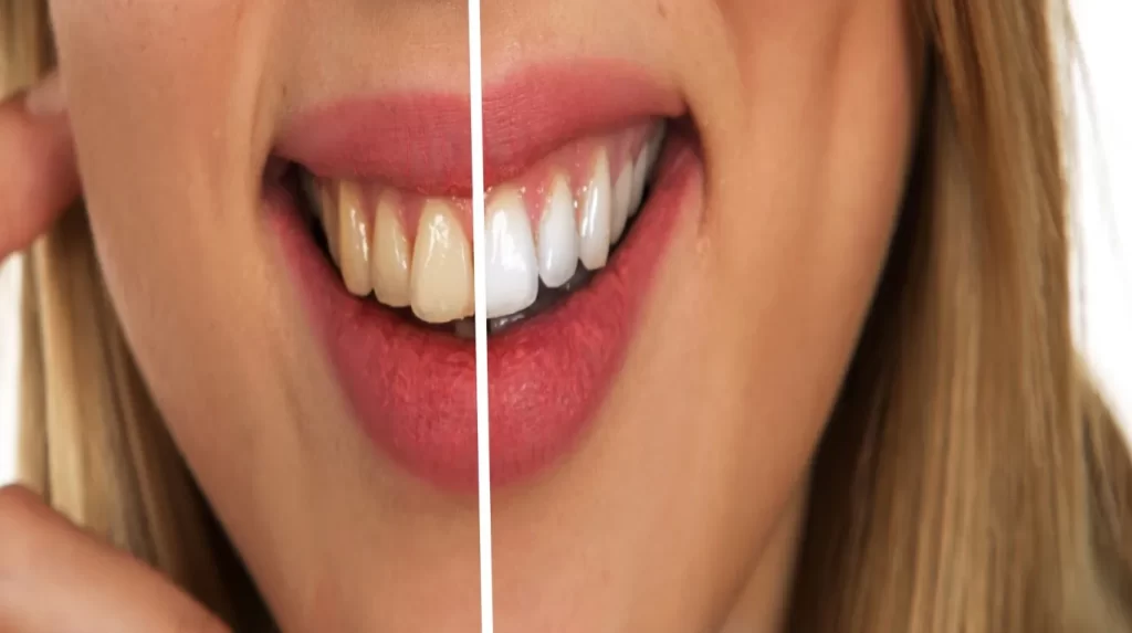 ما هي أهمية طب الأسنان العام؟