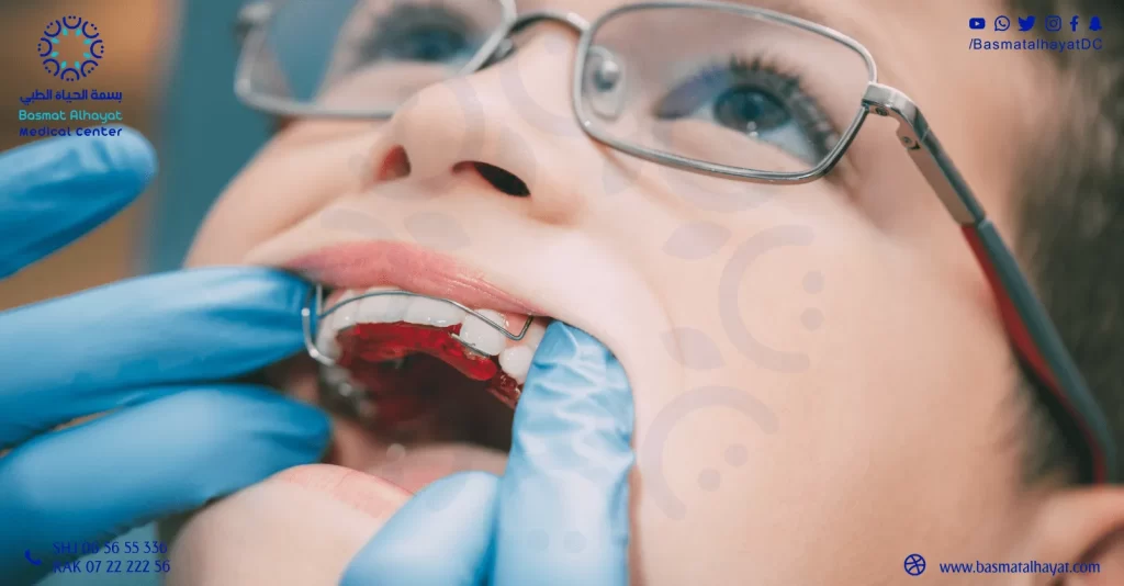 اهمية تقويم الأسنان للأطفال