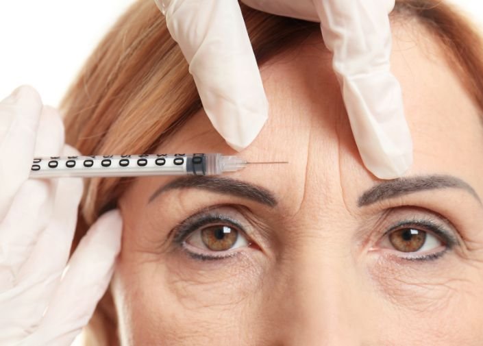 Botox for Facial Wrinkles