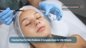 Chemical Peel