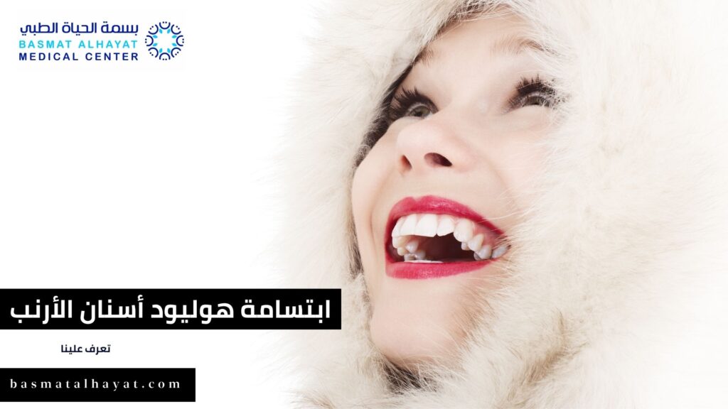 ابتسامة هوليود أسنان الأرنب