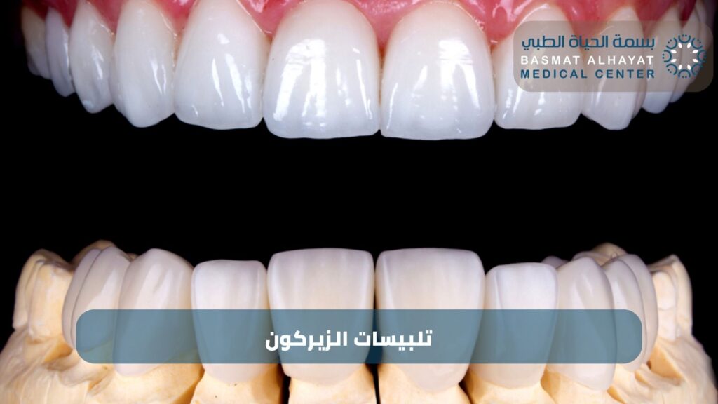 تلبيسات الزيركون