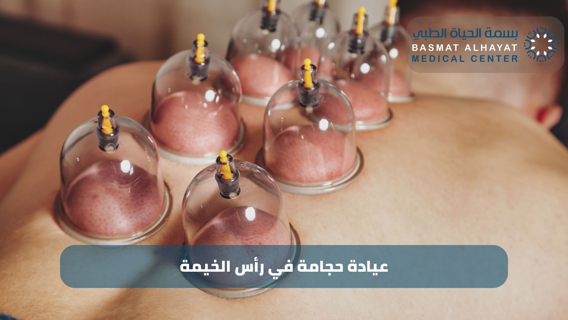 عيادة حجامة في رأس الخيمة