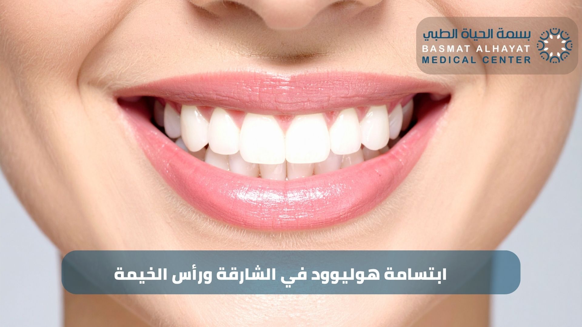 ابتسامة هوليوود