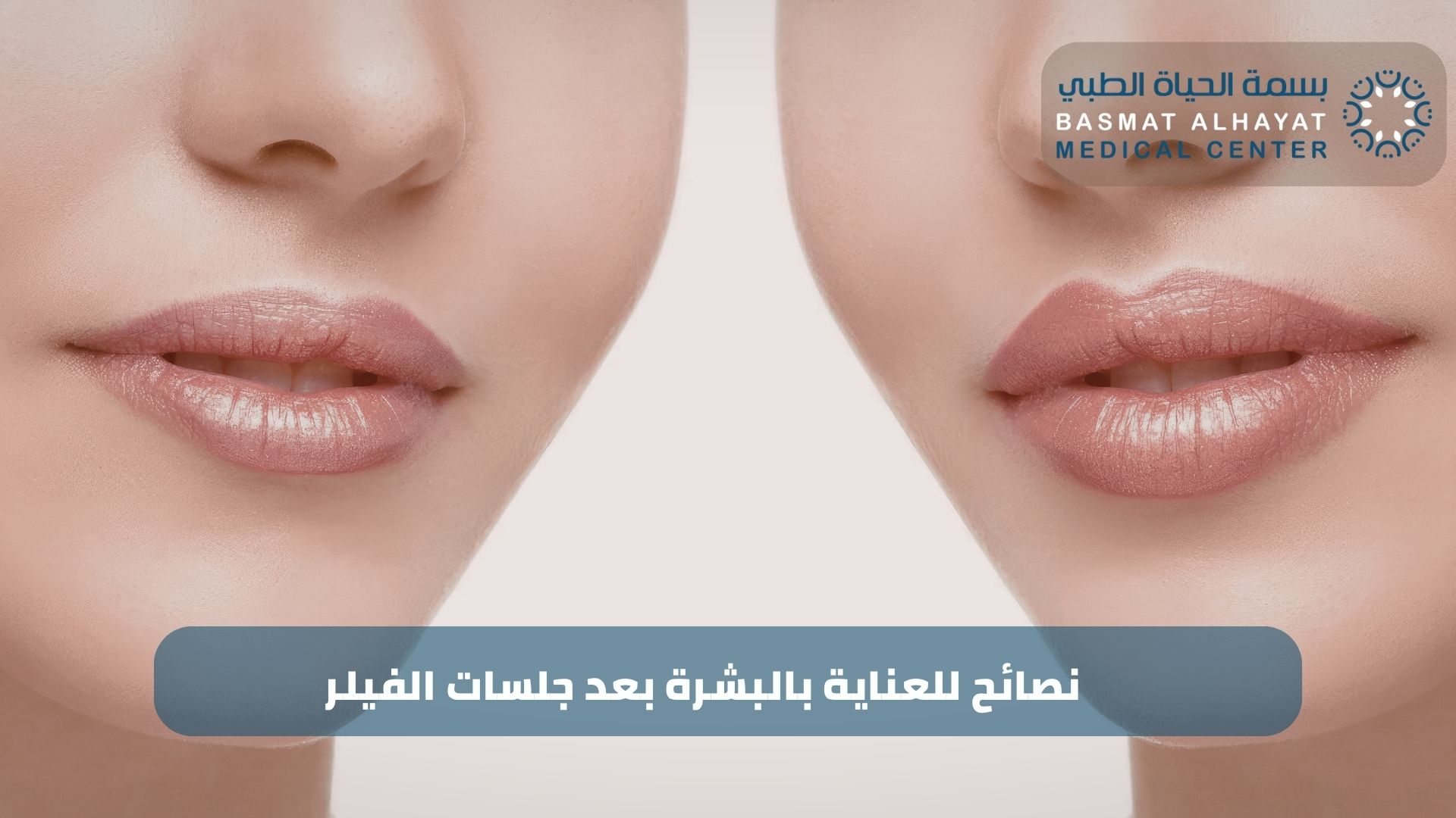 نصائح للعناية بالبشرة بعد جلسات الفيلر