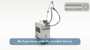 My Experience with the Candela Device