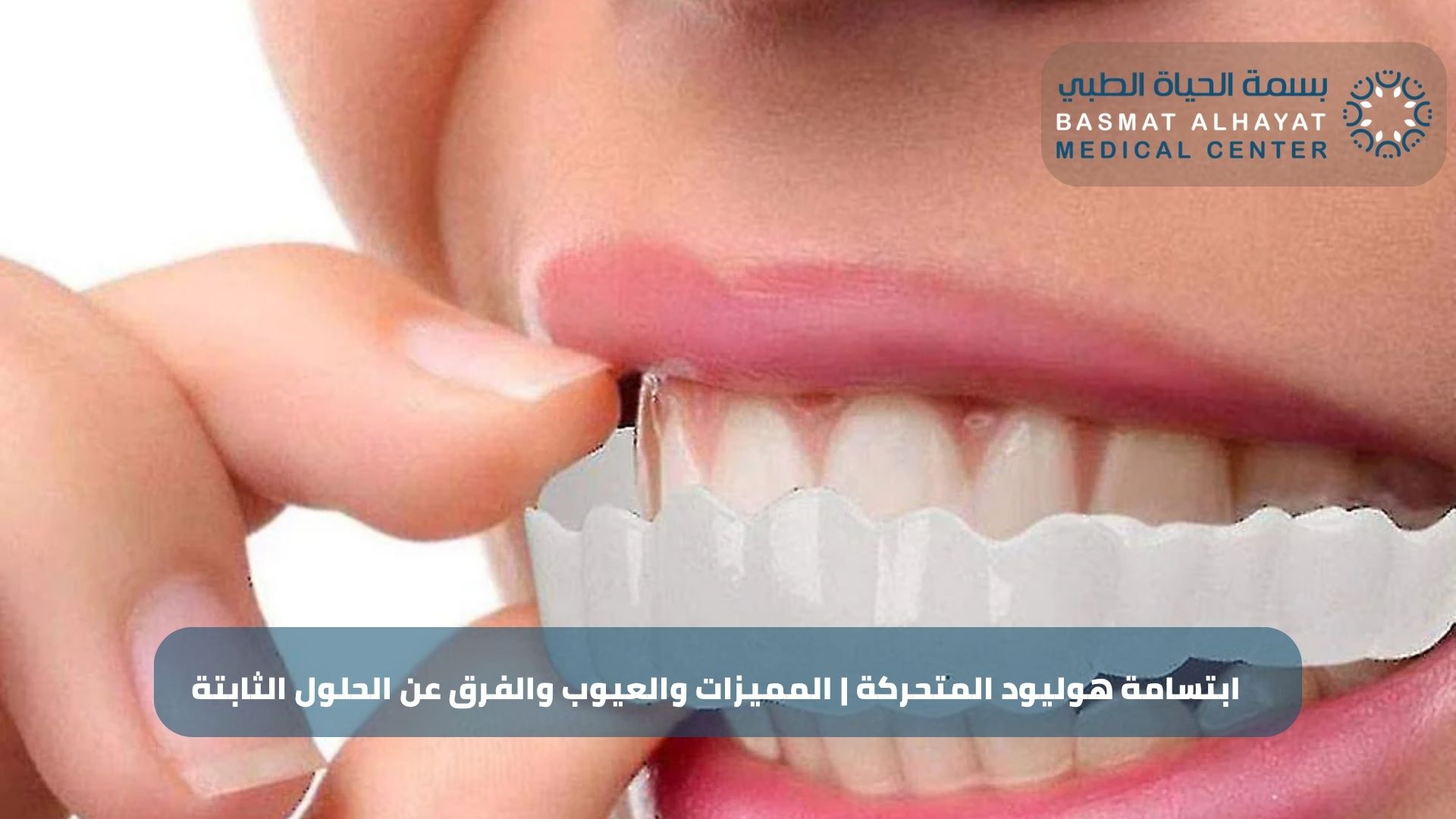 ابتسامة هوليود المتحركة المميزات والعيوب والفرق عن الحلول الثابتة