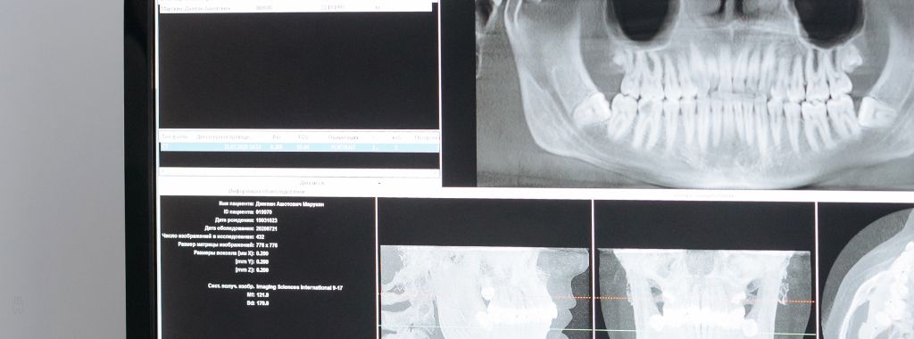 اشعة سينية ( X-ray) لفحص الأسنان اشعة سينية ( X-ray) لفحص الأسنان