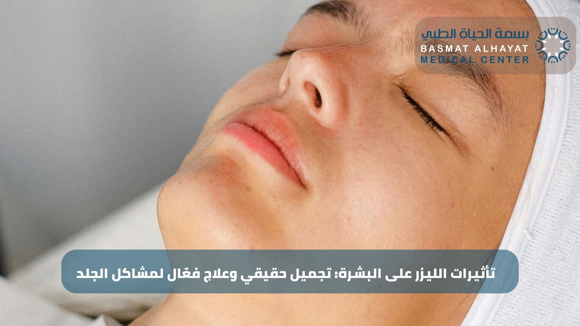 تأثيرات الليزر على البشرة: تجميل حقيقي وعلاج فعّال لمشاكل الجلد