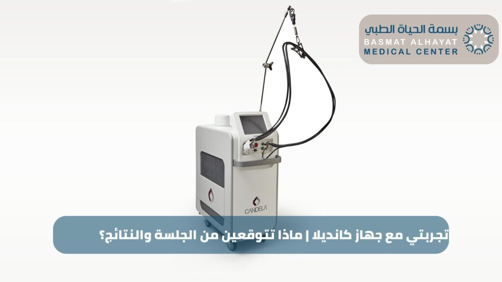 تجربتي مع جهاز كانديلا | ماذا تتوقعين من الجلسة والنتائج؟
