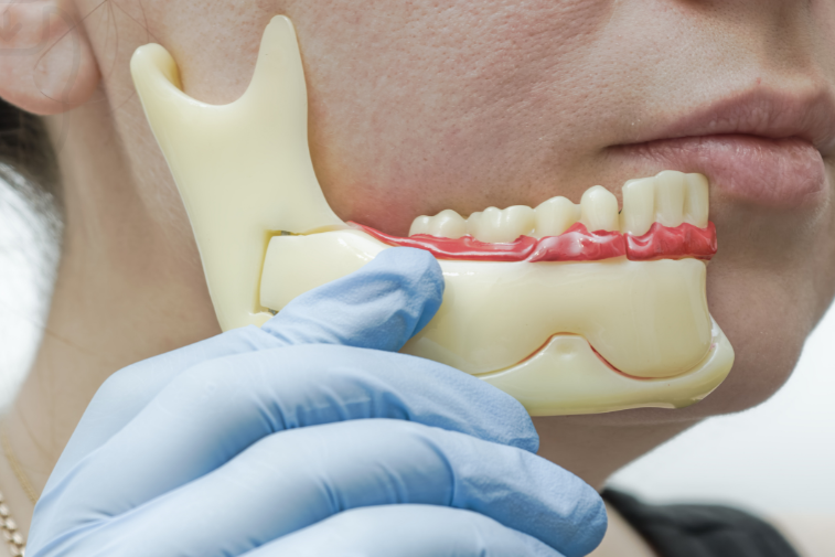 Jawbone Grafting at Basmat Al Hayat Medical Center