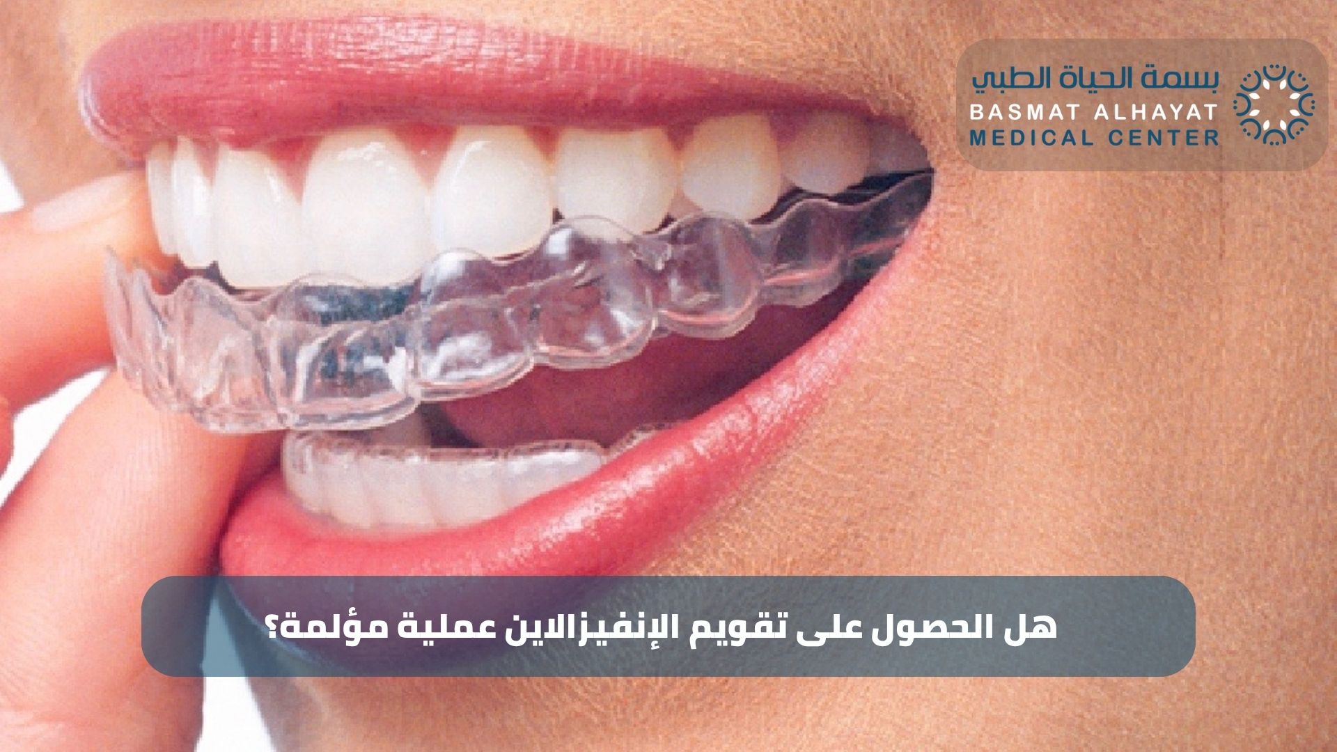 هل الحصول على تقويم الإنفيزالاين عملية مؤلمة؟