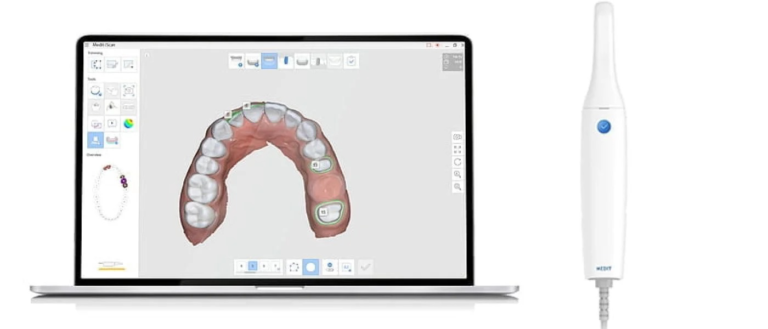Medit i700 الماسح الرقمي للأسنان