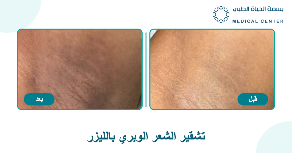 Before and after style educational visual for patient awareness