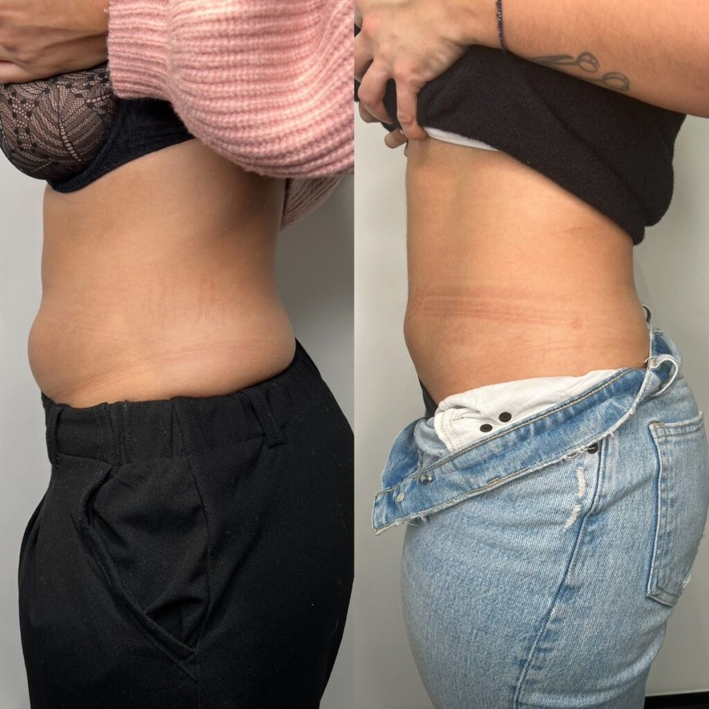 Before and after style educational visual for patient awareness